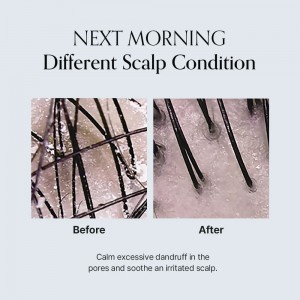 GROWUS Damage Therapy Scalp Ampoule - Εντατική Θεραπεία για Υγιές Τριχωτό & Πιο Πλούσια Μαλλιά