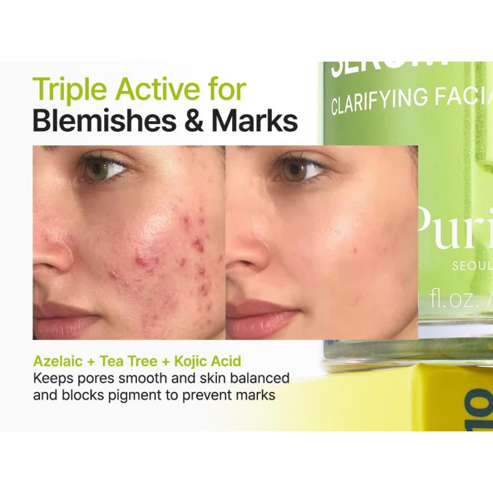 PURITO Azelaic Acid 10 Kojic Tea Tree Serum - Καθαρισμός Ακμής & Σημαδιών