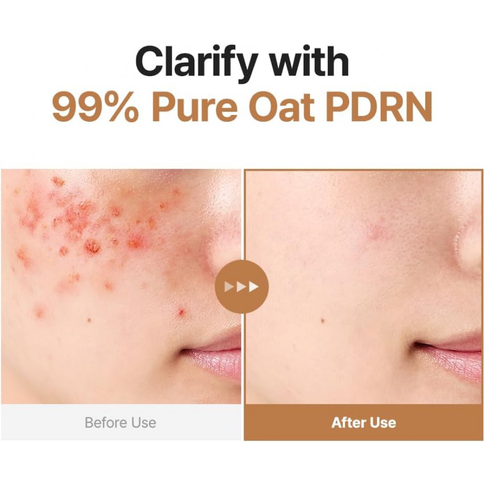 PURITO Oat PDRN Gentle Refining Toner - Καταπραϋντικός Τονωτικός Ορός Βρώμης