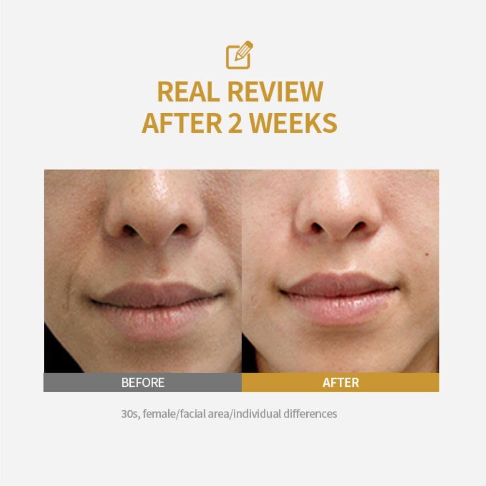 Sungboon Editor Silk Peptide Intensive Lifting Ampoule - Αμπούλα με 3-πλό σύστημα lifting