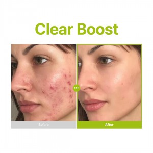 PURITO Azelaic Acid 10 Kojic Tea Tree Serum - Καθαρισμός Ακμής & Σημαδιών