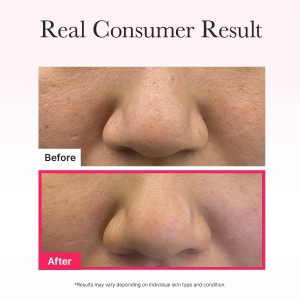 Arencia Red Collagen Jello Mask - Μάσκα Σύσφιξης & Εντατικής Αναζωογόνησης