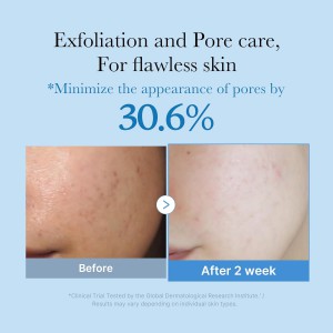 Medicube Zero Pore Toner - Toner Σύσφιξης Πόρων & Ενυδάτωσης