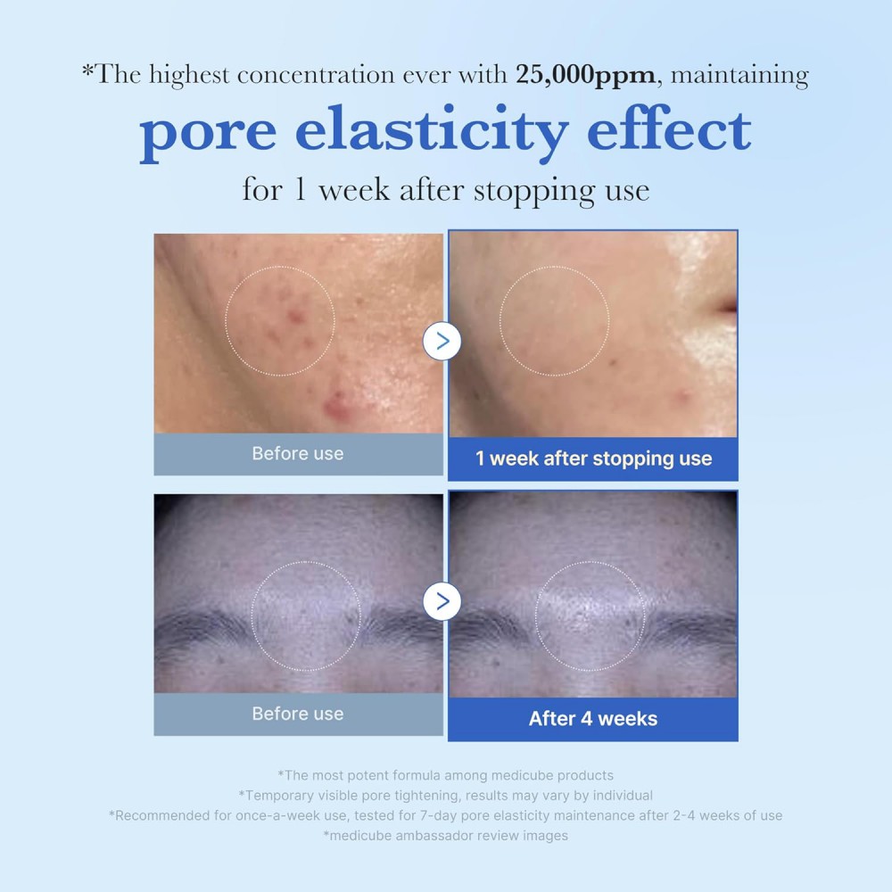 Medicube One Day Exosome Shot Pore Serum 25000 - Ορός micro-needling για λεία υφή & φωτεινό δέρμα