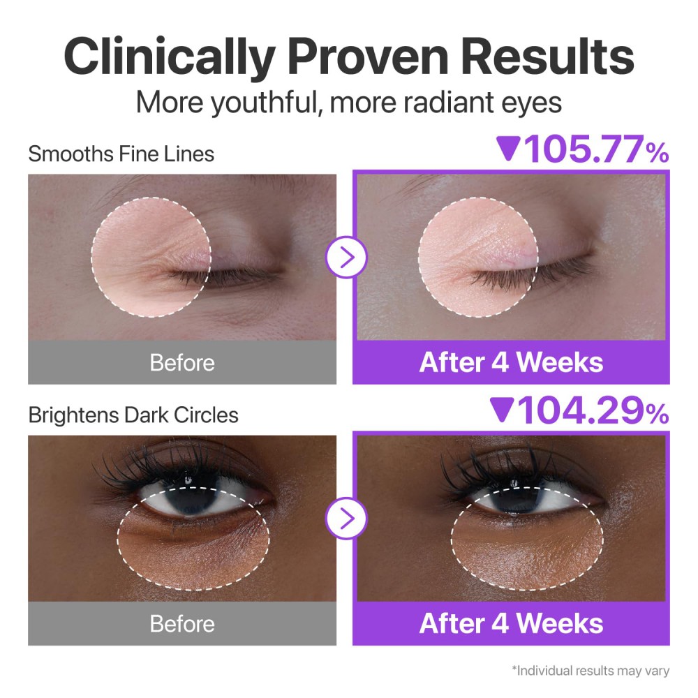 numbuzin No.9 NAD Retinol Volumetox Eye Cream - Συσφιγκτική Κρέμα Ματιών με NAD+ & Ρετινόλη για Λεία, Ξεκούραστη Όψη