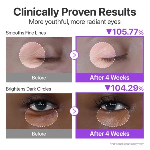 numbuzin No.9 NAD Retinol Volumetox Eye Cream - Συσφιγκτική Κρέμα Ματιών με NAD+ & Ρετινόλη για Λεία, Ξεκούραστη Όψη