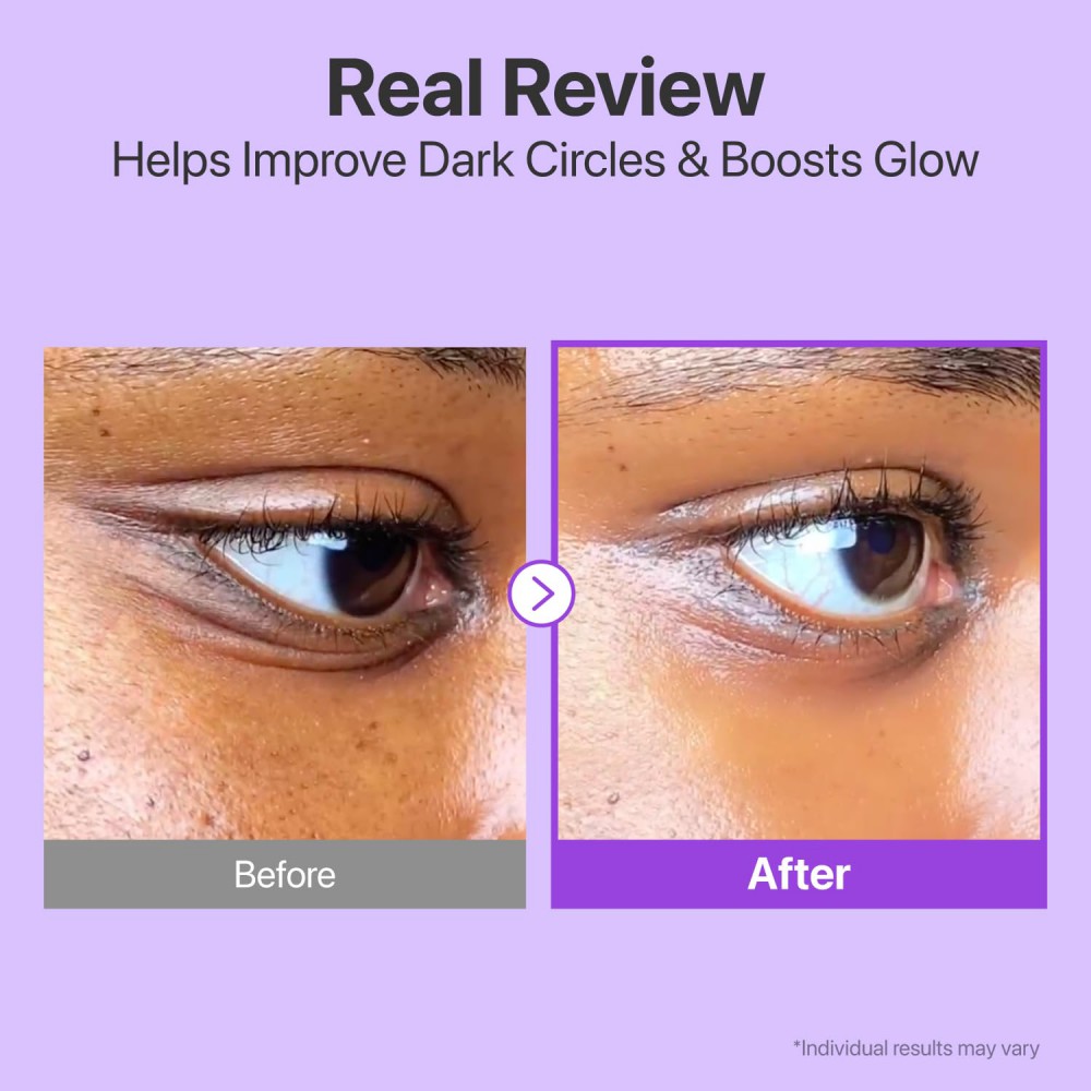 numbuzin No.9 NAD Retinol Volumetox Eye Cream - Συσφιγκτική Κρέμα Ματιών με NAD+ & Ρετινόλη για Λεία, Ξεκούραστη Όψη