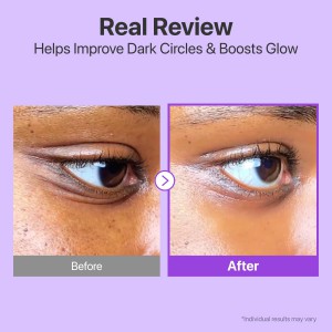 numbuzin No.9 NAD Retinol Volumetox Eye Cream - Συσφιγκτική Κρέμα Ματιών με NAD+ & Ρετινόλη για Λεία, Ξεκούραστη Όψη