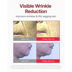 Centellian24 Madeca Cream Time Reverse - Αντιγηραντική Κρέμα Ολικής Επανόρθωσης