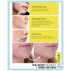 By Wishtrend Sulfur 3% Clean Gel - Τζελ με Θείο για Σπυράκια & Λιπαρότητα