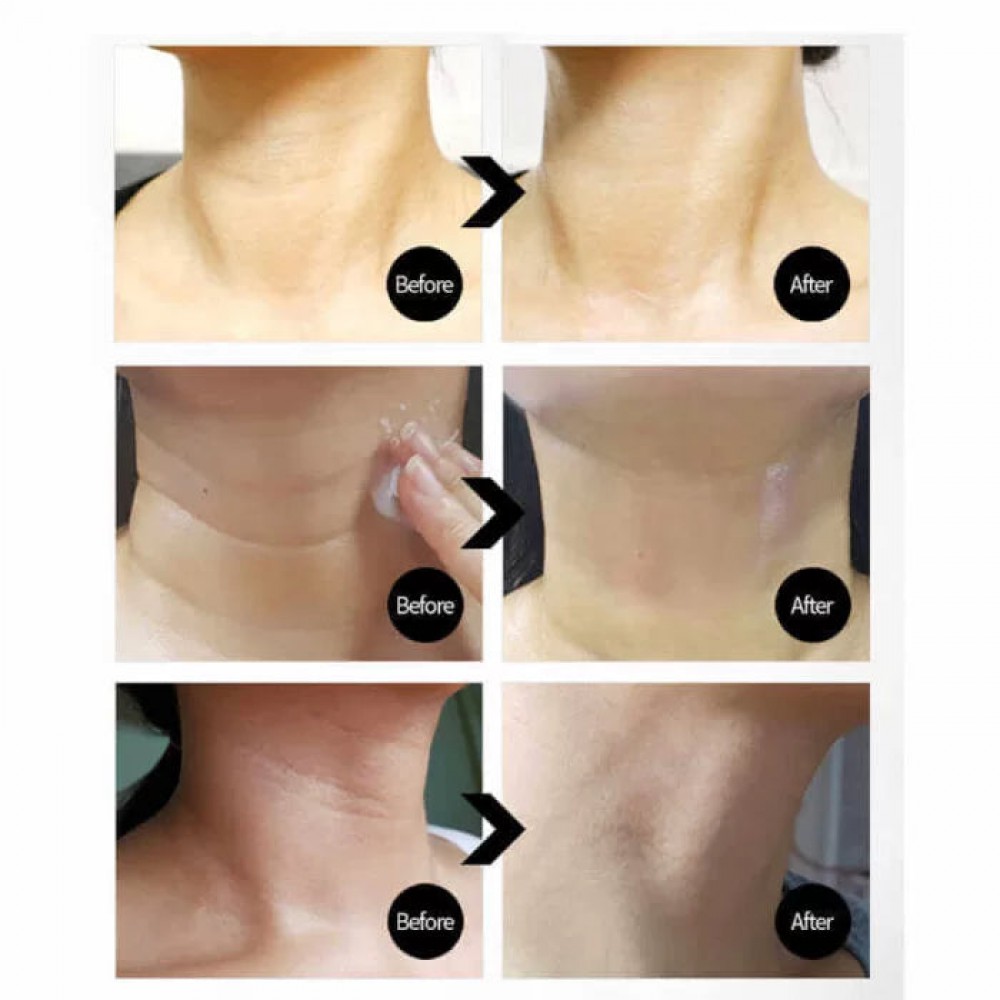 MEDI-PEEL Premium 3.0 Collagen Naite Thread Neck Cream – Αντιγηραντική κρέμα λαιμού με κολλαγόνο