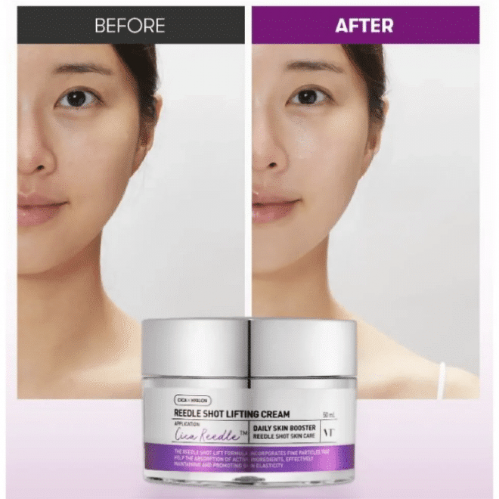 VT Cosmetics Reedle Shot Lifting Cream – Κρέμα Σύσφιξης & Αντιγήρανσης